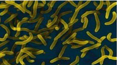 微生物菌劑好？好在哪里您知道嗎？